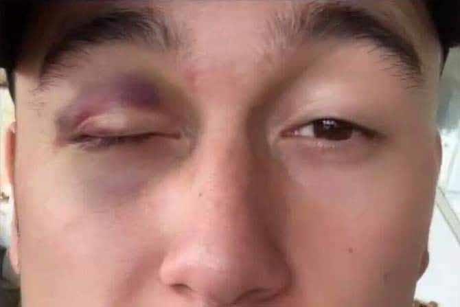 Van Lam khoe mat tham tren mang xa hoi hinh anh