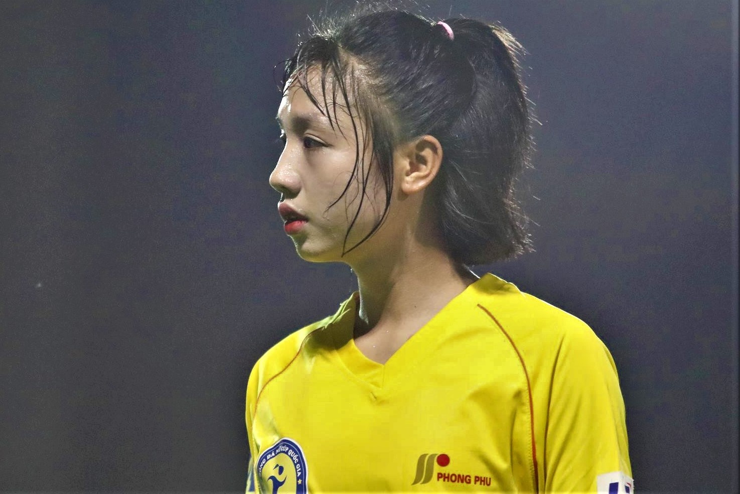 Chuong Thi Kieu co the khong can phau thuat day chang cheo truoc anh 1