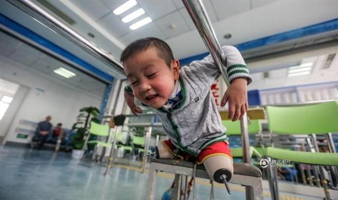 Hiện giờ, Xiaofeng vẫn phải nghỉ ngơi khi cậu đeo những đôi chân giả quá dài và cảm thấy bị đau ở chân.