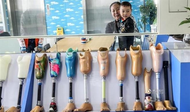 Nếu mọi thứ diễn ra suôn sẻ, Xiaofeng sẽ được trang bị chân giả thực sự sau ngày nghỉ sắp tới. Sau đó, đứa trẻ 4 tuổi có thể học cách uốn cong đầu gối của mình và đi bộ một cách độc lập. Ước chừng sẽ mất khoảng một tháng hoặc lâu hơn để thực hiện những điều đó.