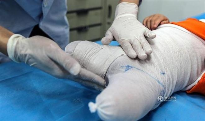 Các bác sĩ nói, Xiaofeng sẽ được chăm sóc tốt hơn ở trung tâm phục hồi, vì tại những bệnh viện mà cậu điều trị trước đây thường xuyên đông đúc và bận rộn. 