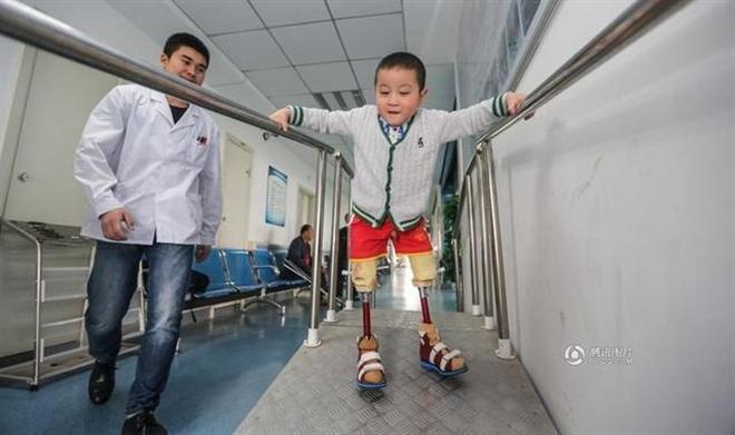 Theo các bác sĩ phục hồi chức năng , họ sẽ cho Xiaofeng đá những quả bóng để tập luyện phản xạ cho đôi chân.