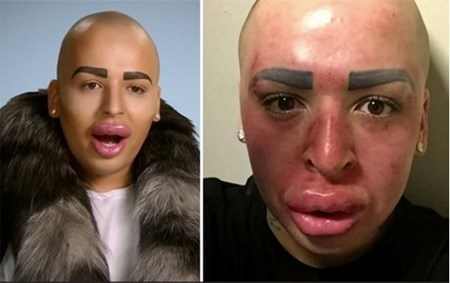 Bản sao nam giới của Kim Kardashian.