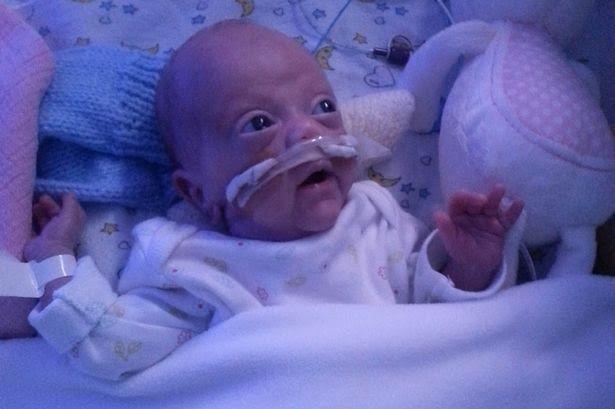 Suc song ky dieu cua dua be bi bac si tu bo hinh anh