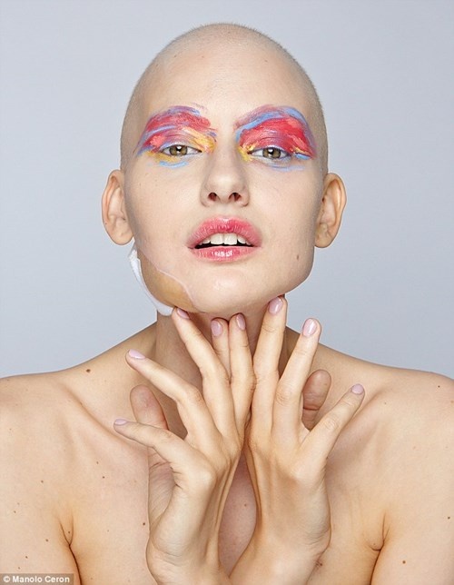 Kết quả X-quang cho thấy: thực chất cơn đau mà Elizaveta tưởng là đau răng ấy lại là biểu hiện của một khối u xương ác tính phát triển ở hàm.