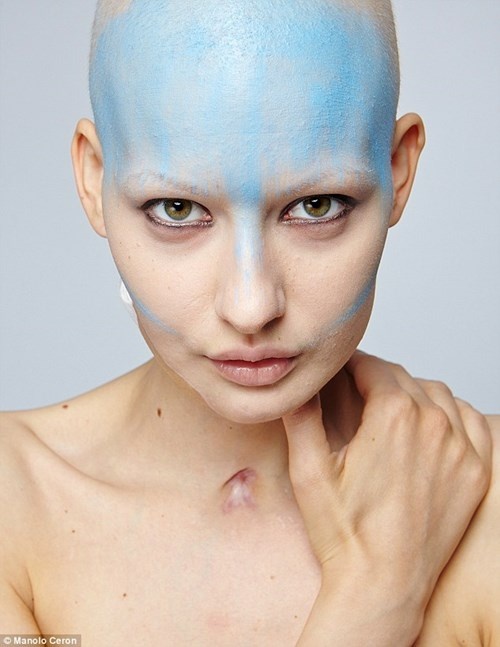 Đến nay, cậu con trai của Elizaveta đã tròn 14 tháng tuổi, và cô cũng vừa trải qua đợt xạ trị thứ 4. Trong bộ ảnh mới thực hiện này, Elizaveta không hề ngại ngần hay che giấu những vết sẹo phẫu thuật trên cơ thể mình. Bởi cô mong muốn sẽ truyền được sức chiến đấu mạnh mẽ của mình đến những người cũng mắc căn bệnh ung thư như cô. 