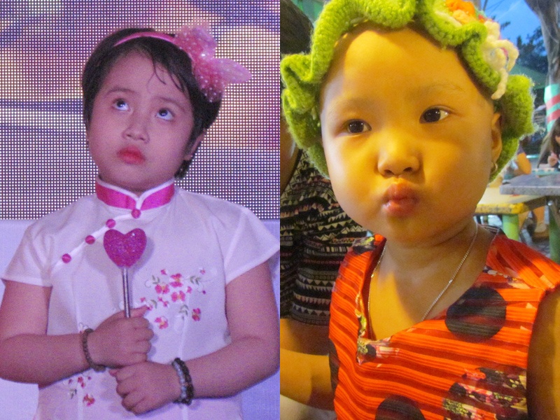 Hanh trinh thuc hien uoc mo cua 2 em nho mac benh hiem ngheo hinh anh