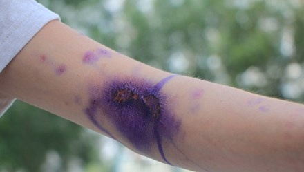 Sinh vien lo loet vi bi kien ba khoang tan cong hinh anh