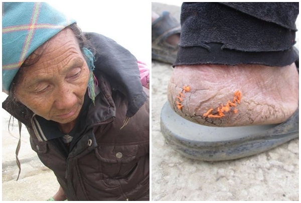 Dan mang keu goi giup do cu ba dung chi khau got chan hinh anh