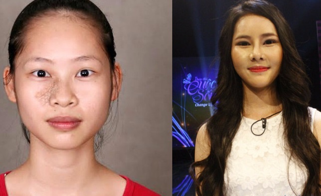 nu sinh su pham phau thuat tham my anh 1