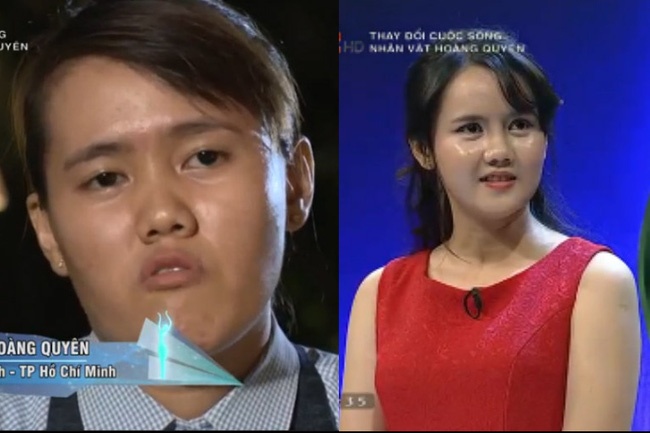 cô gái móm phẫu thuật xinh như búp bê ảnh 1 co gai mom phau thuat xinh nhu bup be anh 1