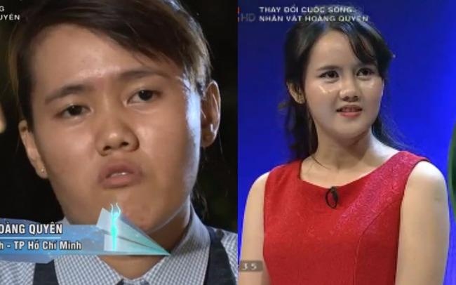 Co gai Sai Gon bi mom tro nen xinh dep nho dao keo hinh anh