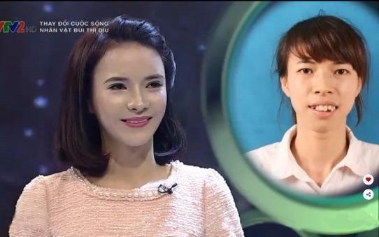 Bui Thi Diu xinh dep sau phau thuat tham my hinh anh