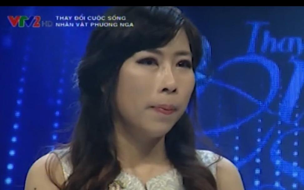 Pham Phuong Nga - Thay doi sau phau thuat tham my hinh anh