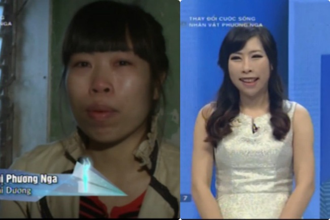 phẫu thuật thẩm mỹ vì nhà bạn trai chê ảnh 1 phau thuat tham my vi nha ban trai che anh 1