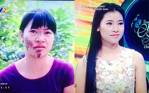 Co gai dan toc xinh dep sau dao keo anh 1