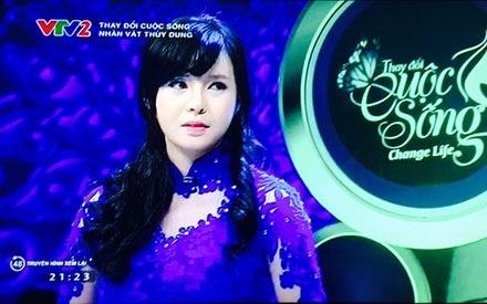 9X xinh dep sau phau thuat tham my hinh anh