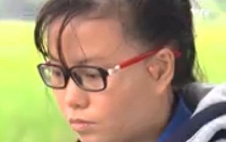 Ngo Thi Du bi di tat bam sinh tu nho hinh anh