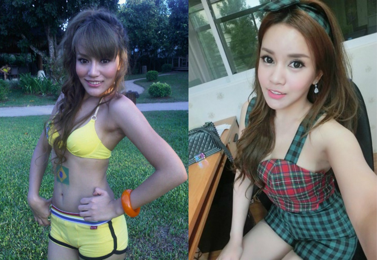 hot girl phau thuat tham my anh 3