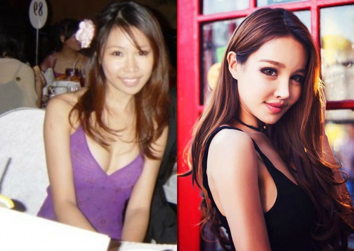 hot girl phau thuat tham my anh 4