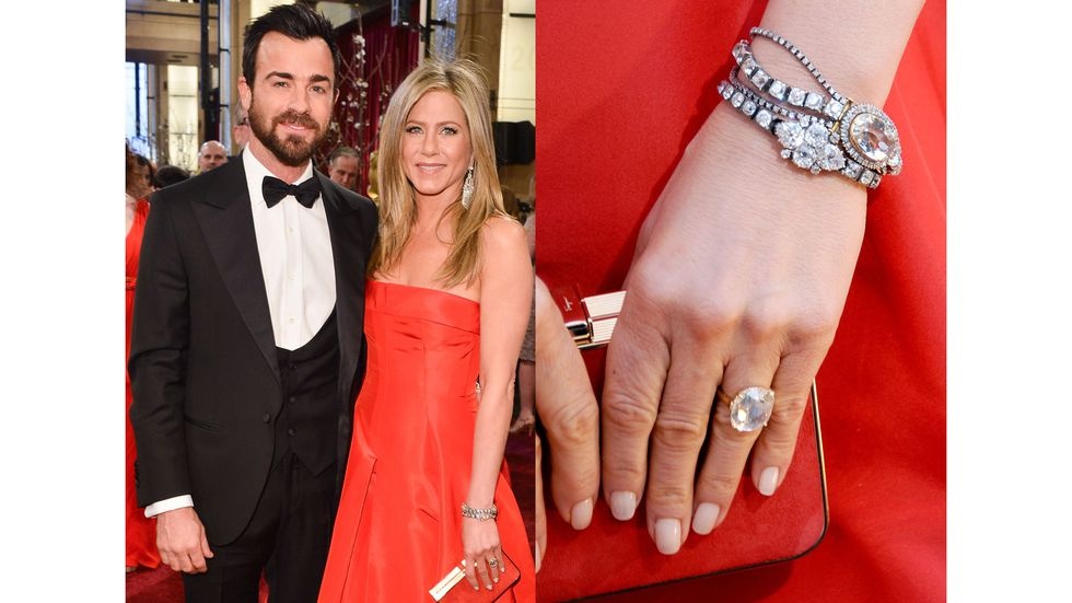 Nhung dinh hon dat do cua my nhan the gioi anh 7