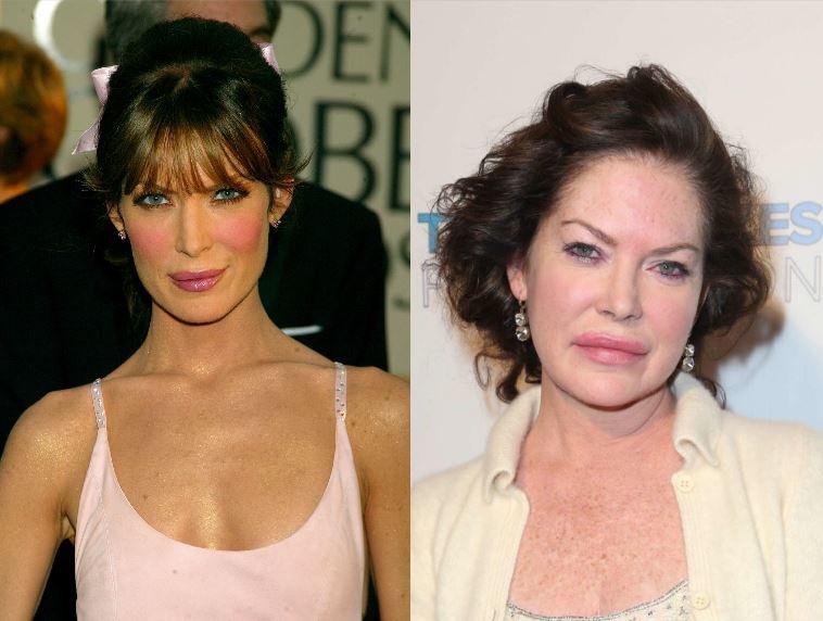 Sao bien dang do phau thuat tham my anh 8