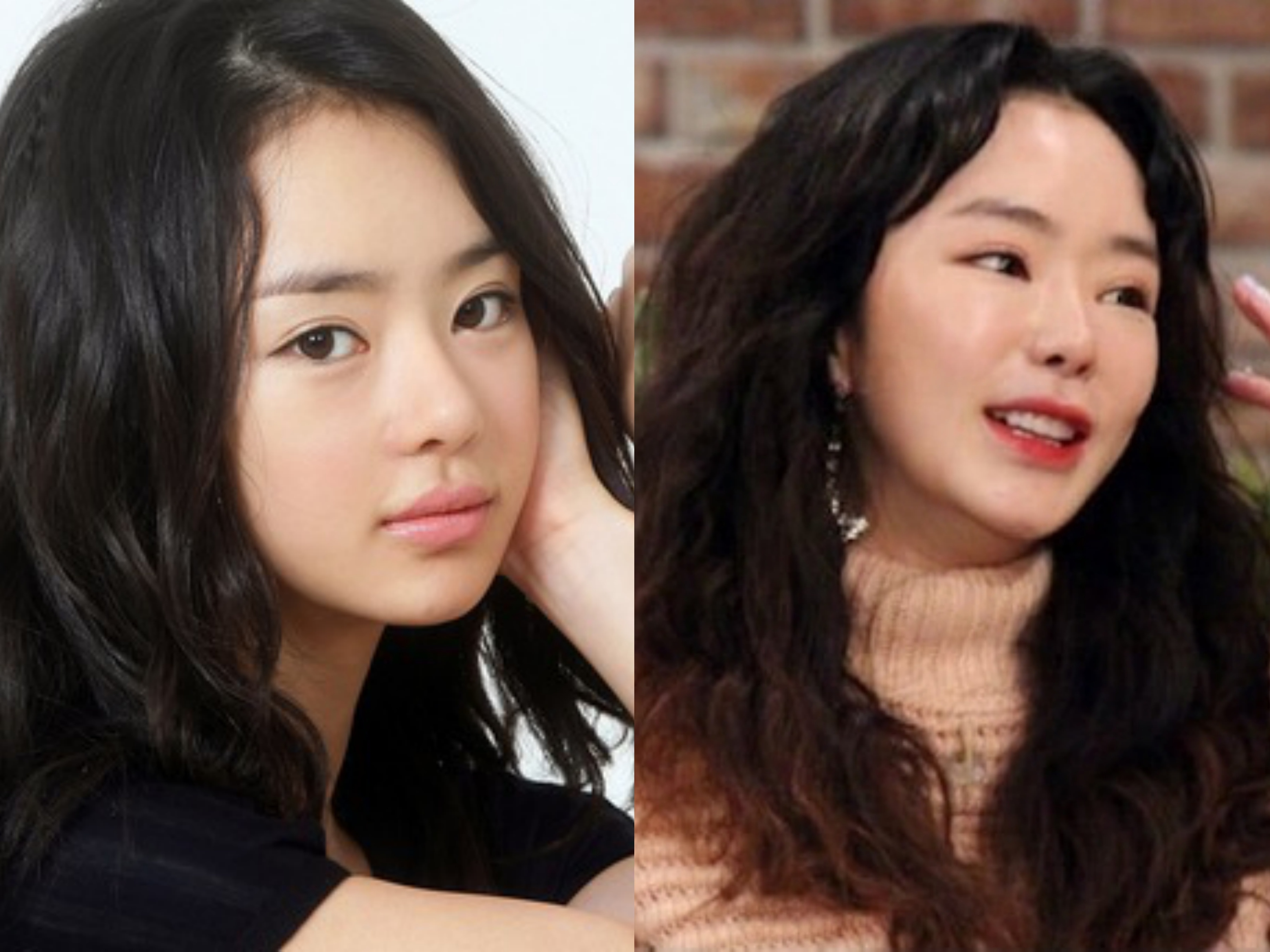 Sao bien dang do phau thuat tham my anh 3