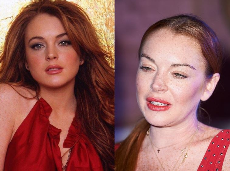 Sao bien dang do phau thuat tham my anh 5