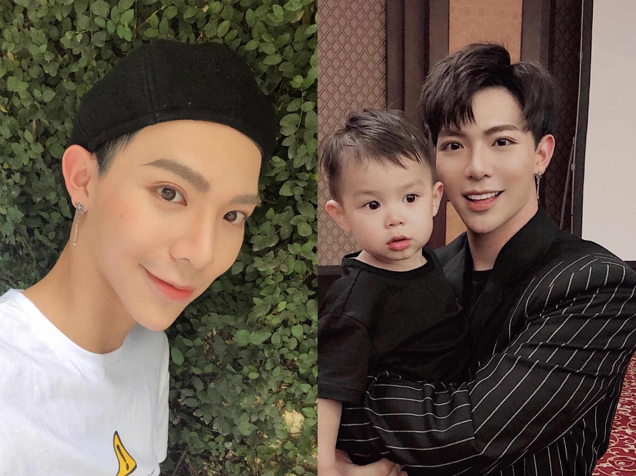 Ca sĩ Erik phẫu thuật thẩm mỹ ảnh 5 Ca si Erik phau thuat tham my anh 5