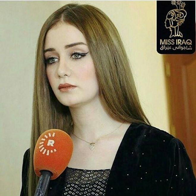 Hoa hau bi tuoc vuong mien anh 6