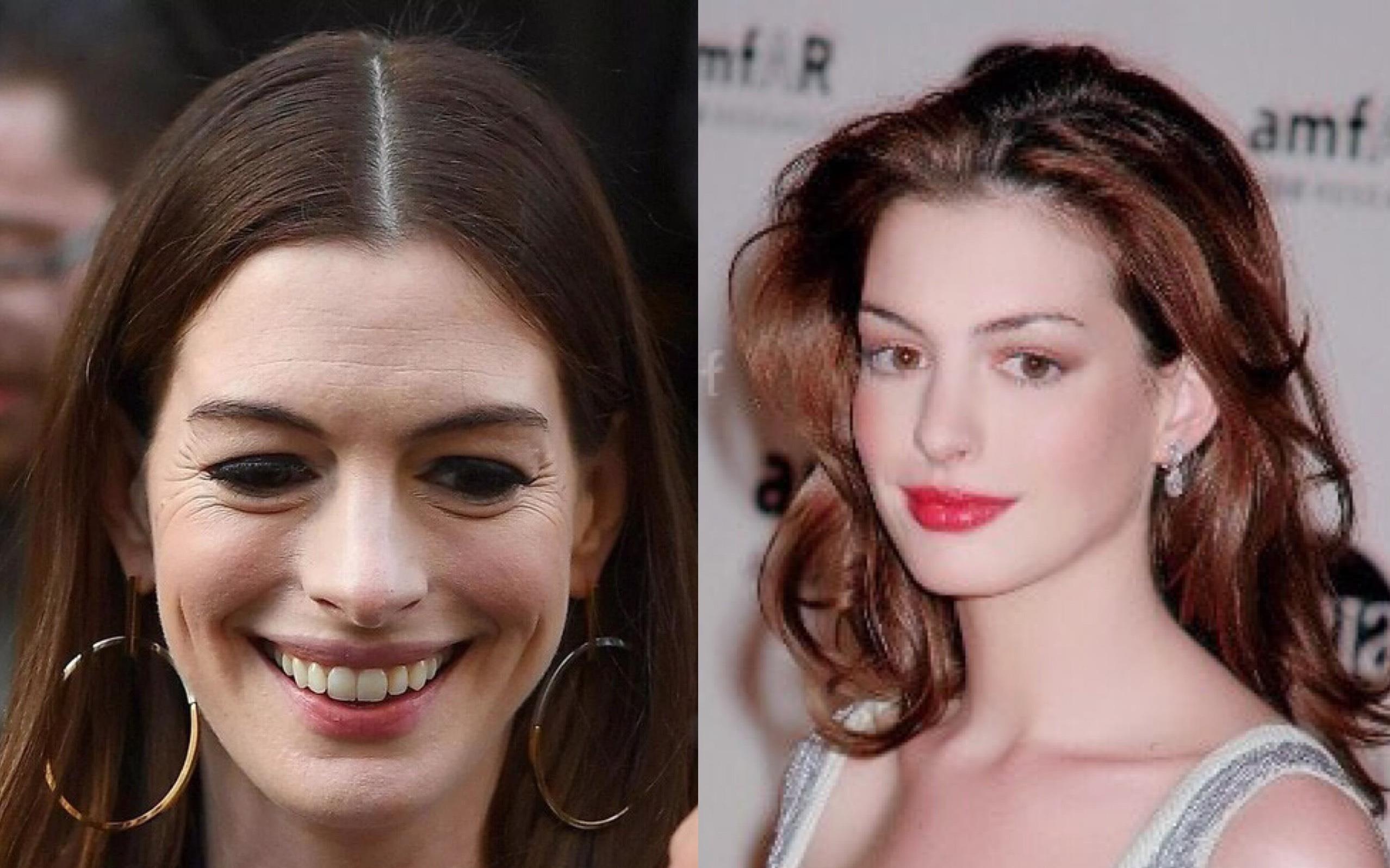 'Cong chua Hollywood' Anne Hathaway xuong sac, mat day nep nhan hinh anh