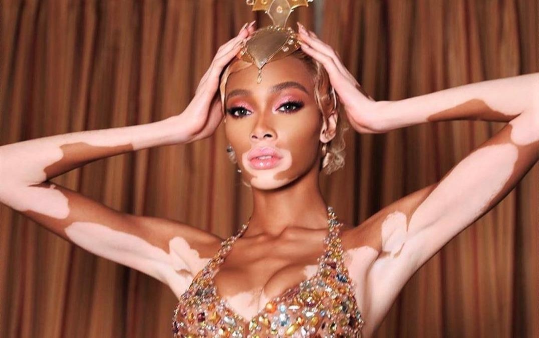 Mau bach bien Winnie Harlow chuong trang phuc mau me hinh anh