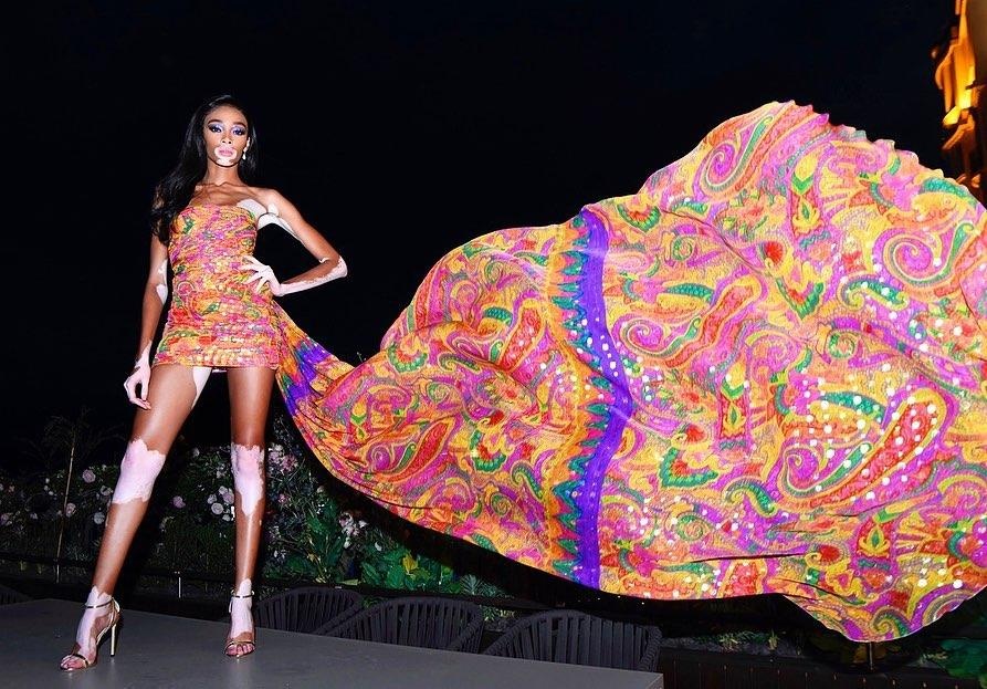 nguoi mau bach bien Winnie Harlow anh 6