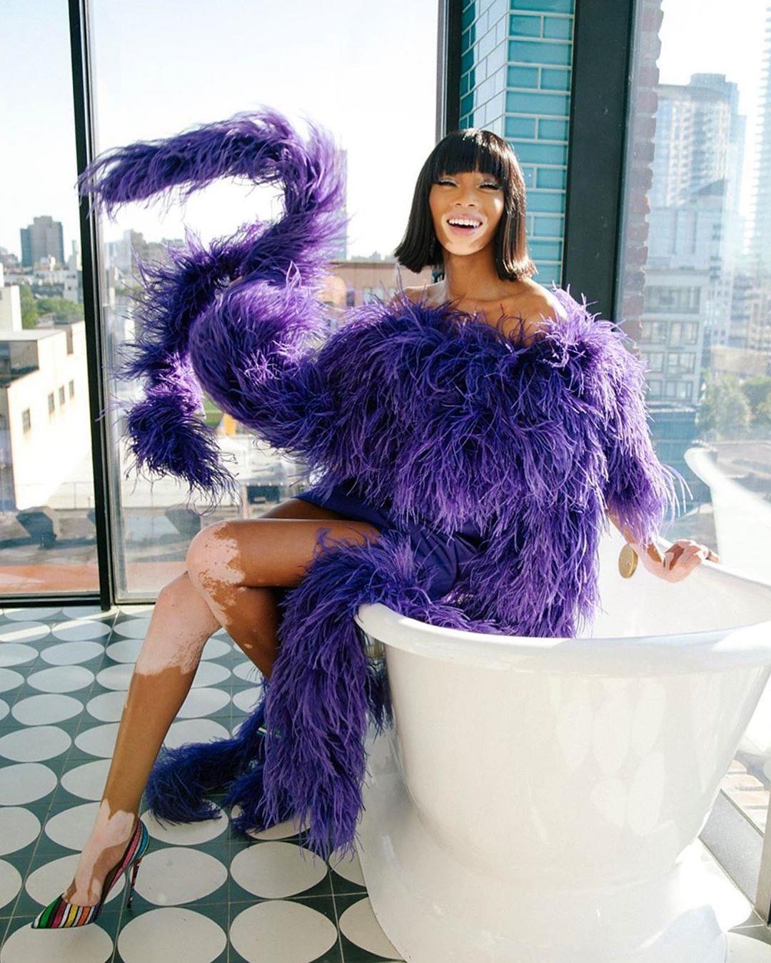 nguoi mau bach bien Winnie Harlow anh 1