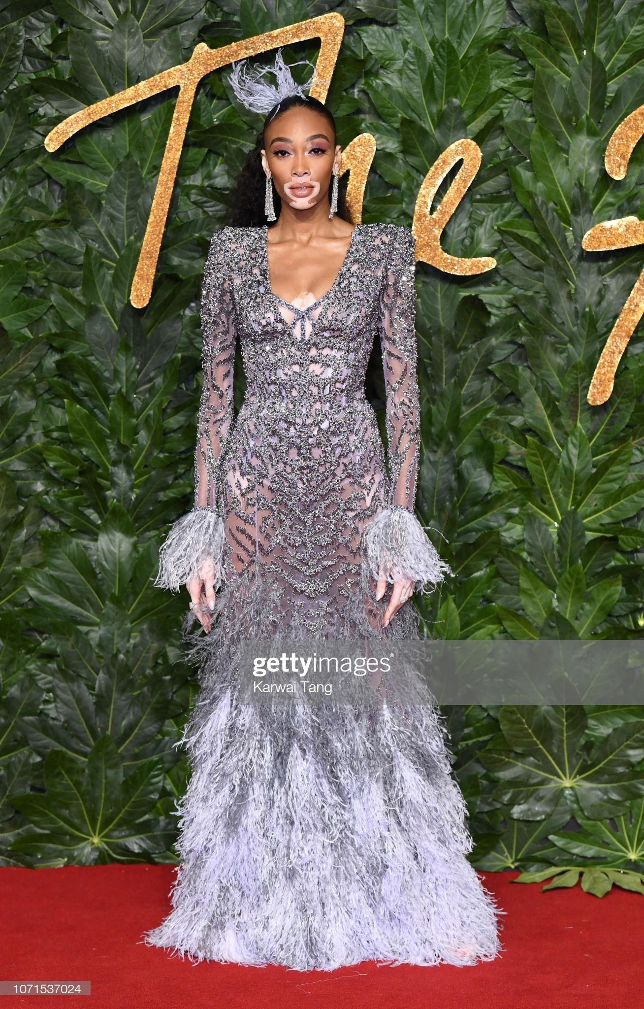 nguoi mau bach bien Winnie Harlow anh 7