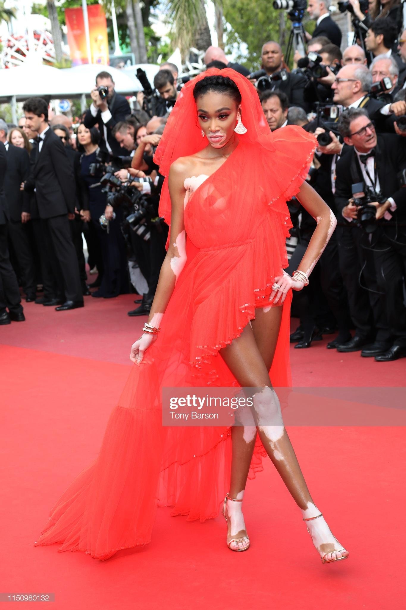 nguoi mau bach bien Winnie Harlow anh 2