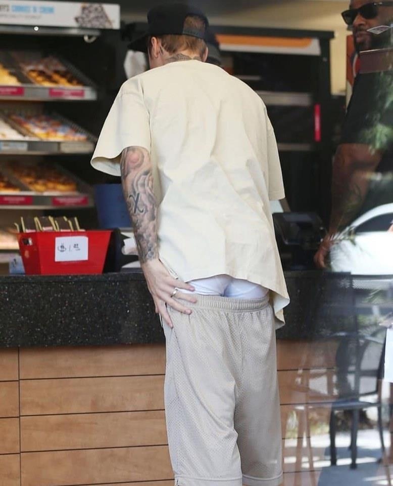 Justin Bieber mặt mụn  ảnh 3 Justin Bieber mat mun anh 3