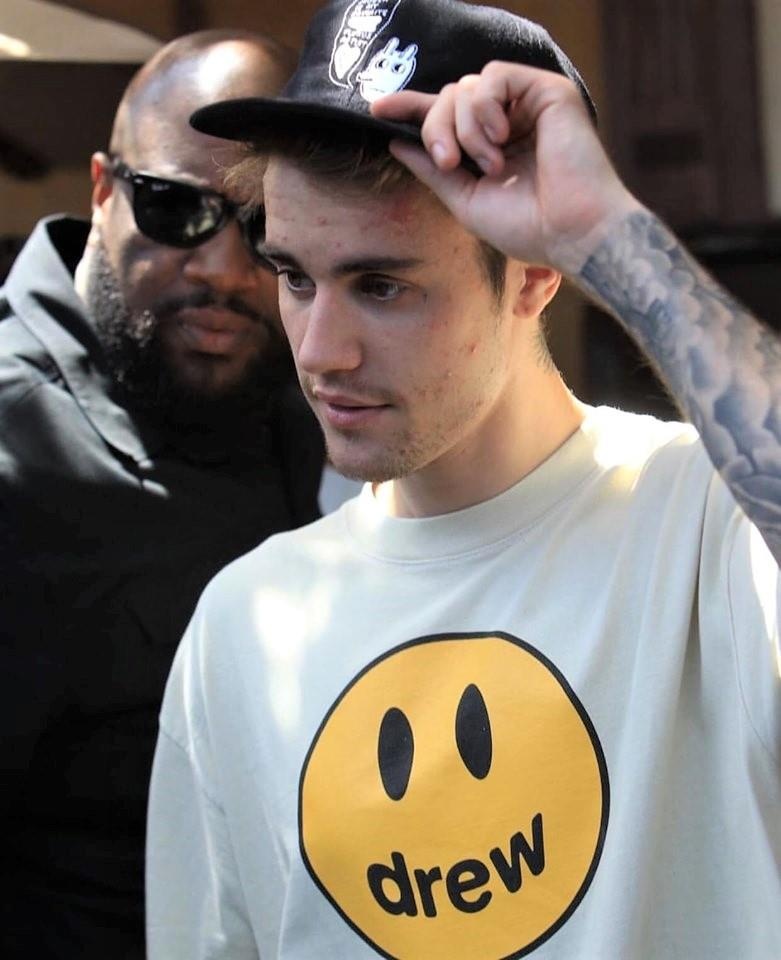 Justin Bieber mặt mụn  ảnh 2 Justin Bieber mat mun anh 2