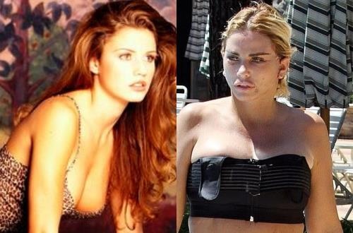 Katie Price - tu nguoi mau nong bong den tham hoa tham my hinh anh