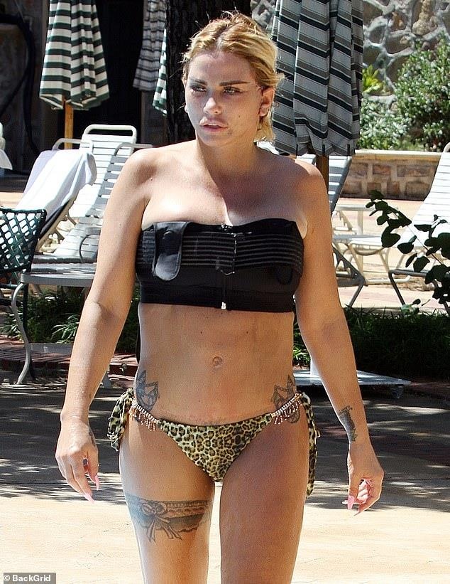 Katie Price phau thuat tham my anh 11