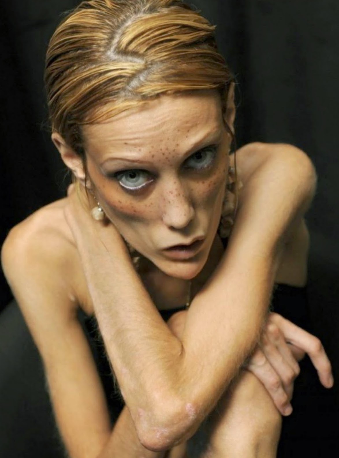 người mẫu chết vì gầy ảnh 2 nguoi mau chet vi gay anh 2