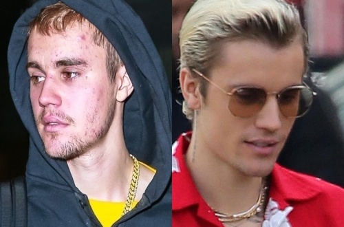 Ve ngoai that thuong cua Justin Bieber hinh anh