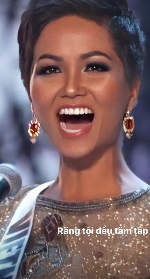 h'hen niê niềng răng ảnh 1 h'hen nie nieng rang anh 1