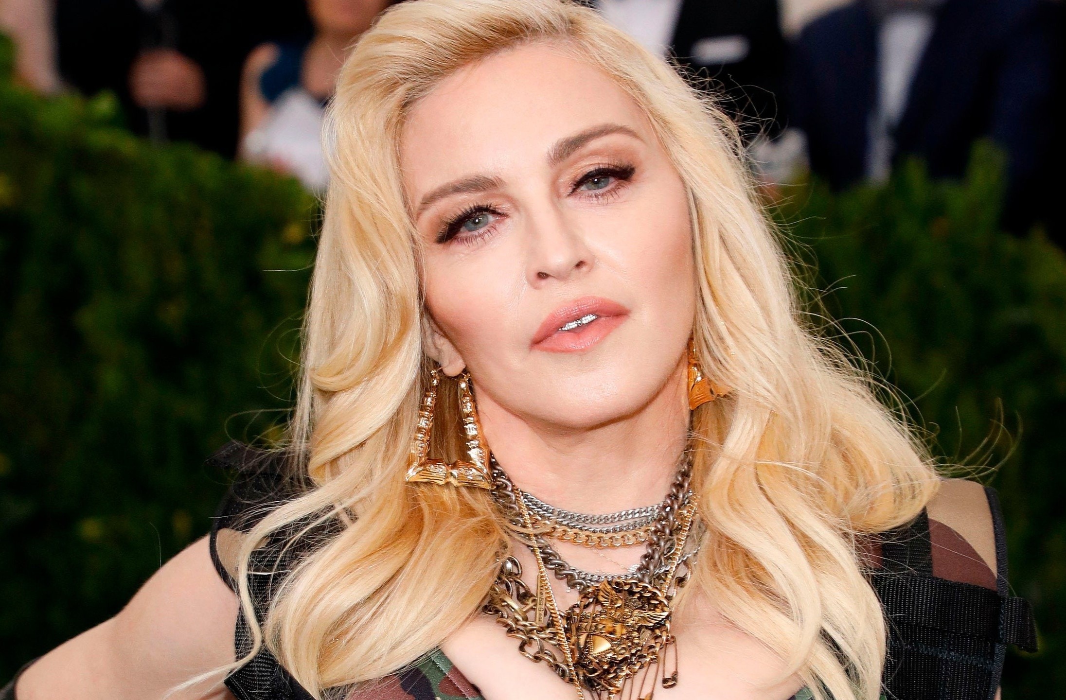 Madonna xac nhan nhiem nCoV hinh anh