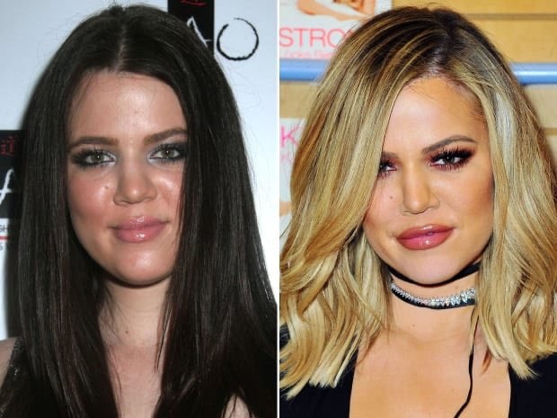 khloe kardashian chinh anh qua da anh 2