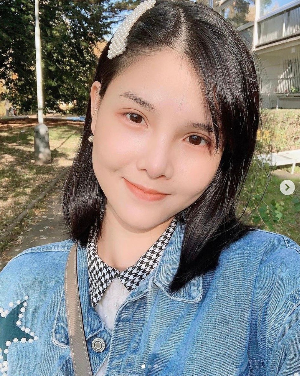 lynk lee phẫu thuật thẩm mỹ ảnh 14 lynk lee phau thuat tham my anh 14