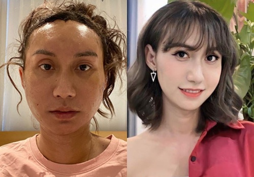 Lynk Lee, Luu De Ly chia se gi khi thua nhan phau thuat tham my? hinh anh