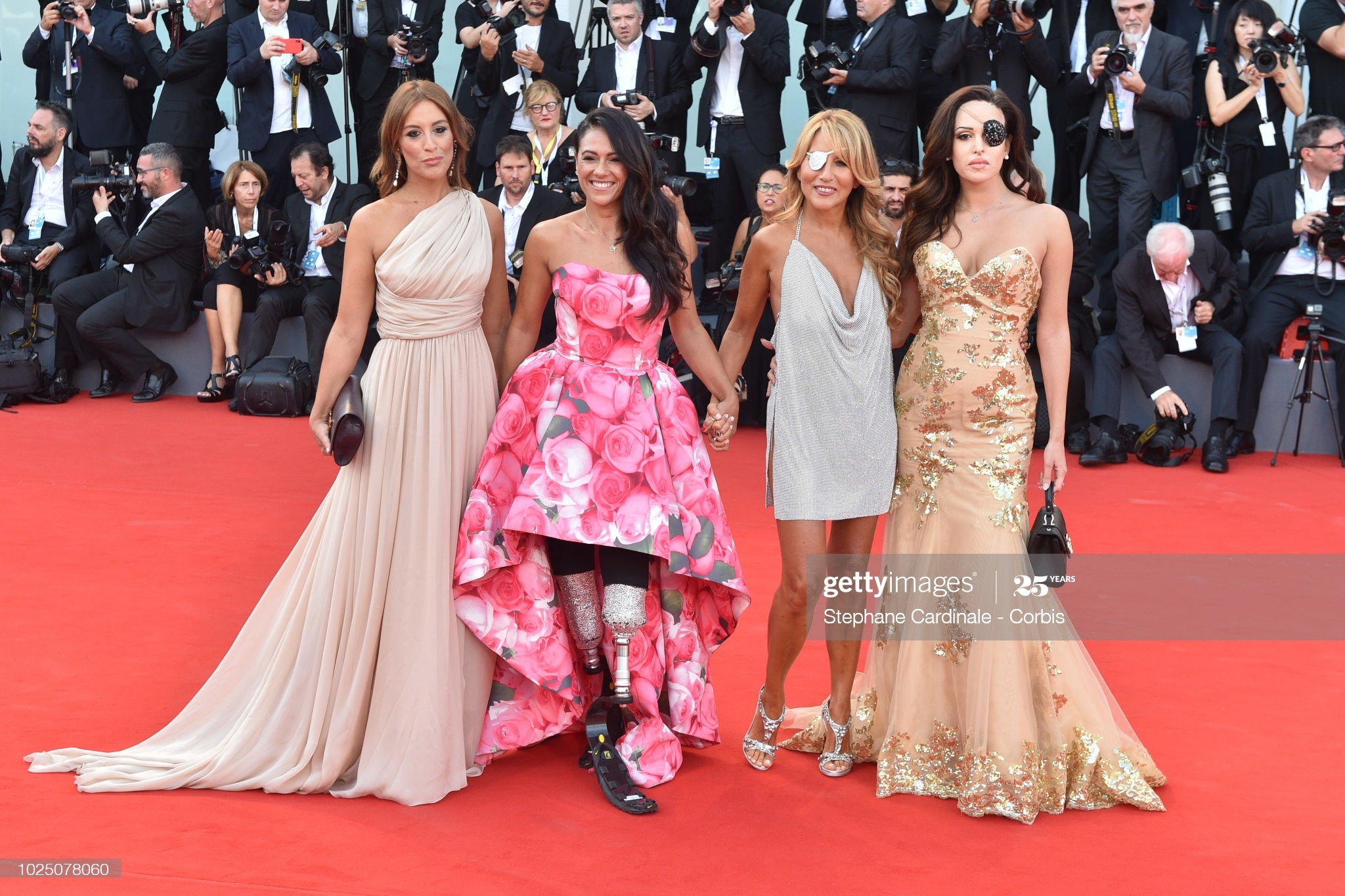 Gessica Notaro bi tat axit anh 3