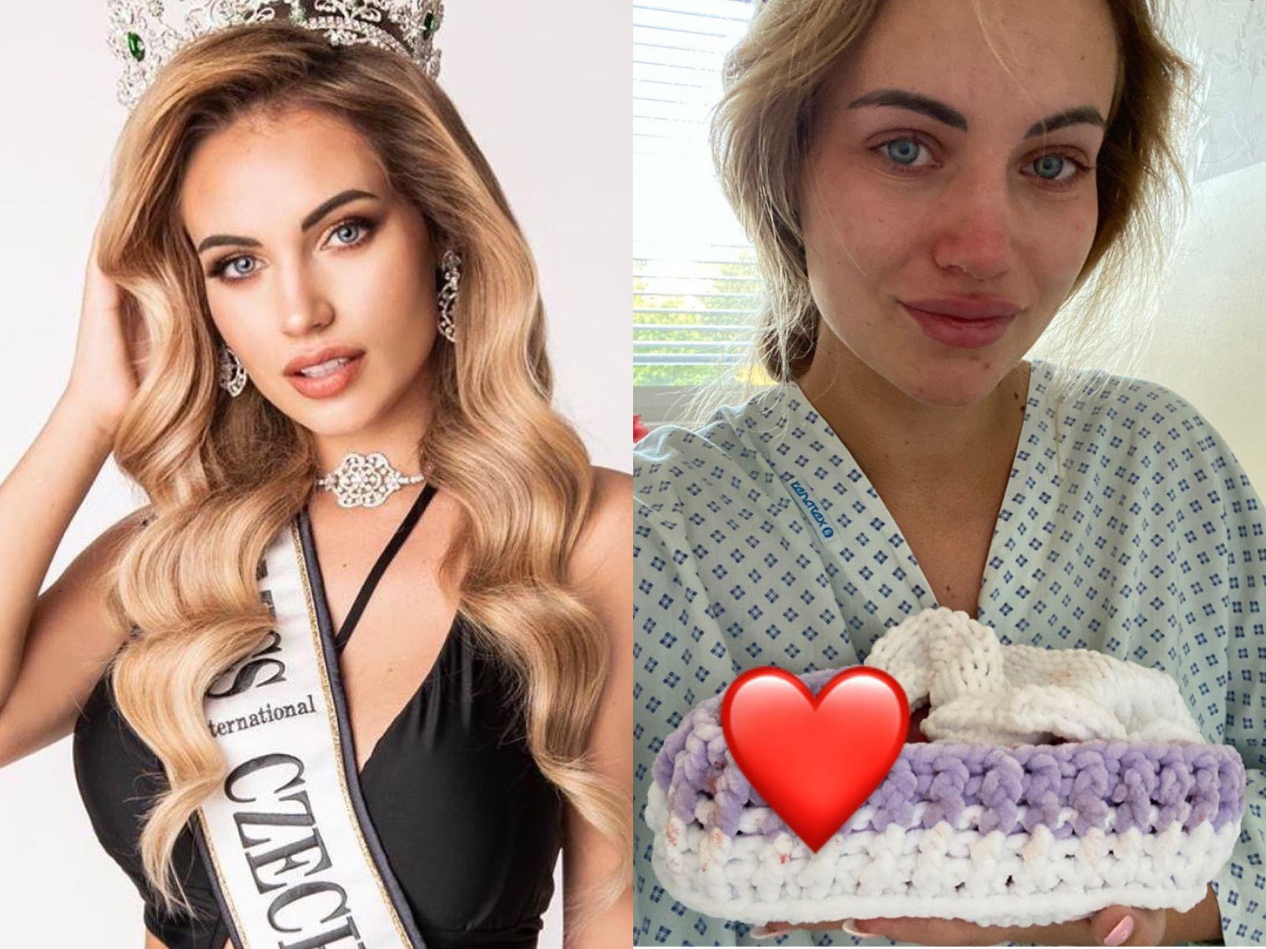 Hoa hau CH Czech sinh con anh 1