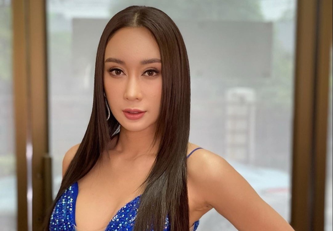 Thi sinh phau thuat tham my duoc du doan len ngoi Hoa hau Trai Dat hinh anh